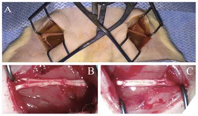 Allogenic Adipose Derived Stem Cells Transplantation Improved Sciatic Nerve Regeneration in Rats: Autologous Nerve Graft Model